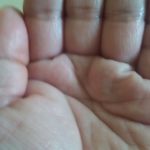 ひどい手汗、足汗を治す方法は本当に存在するのか？